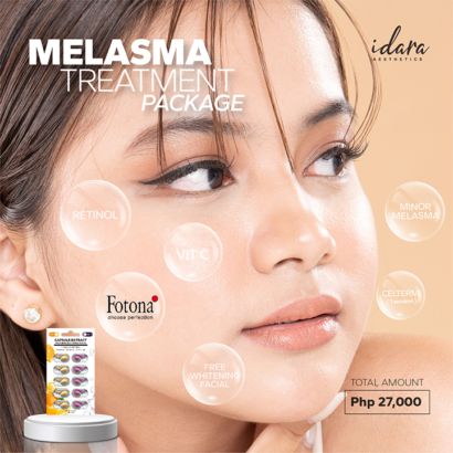 Melasma Treatment