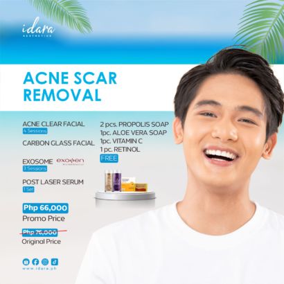 Acne Scar Removal