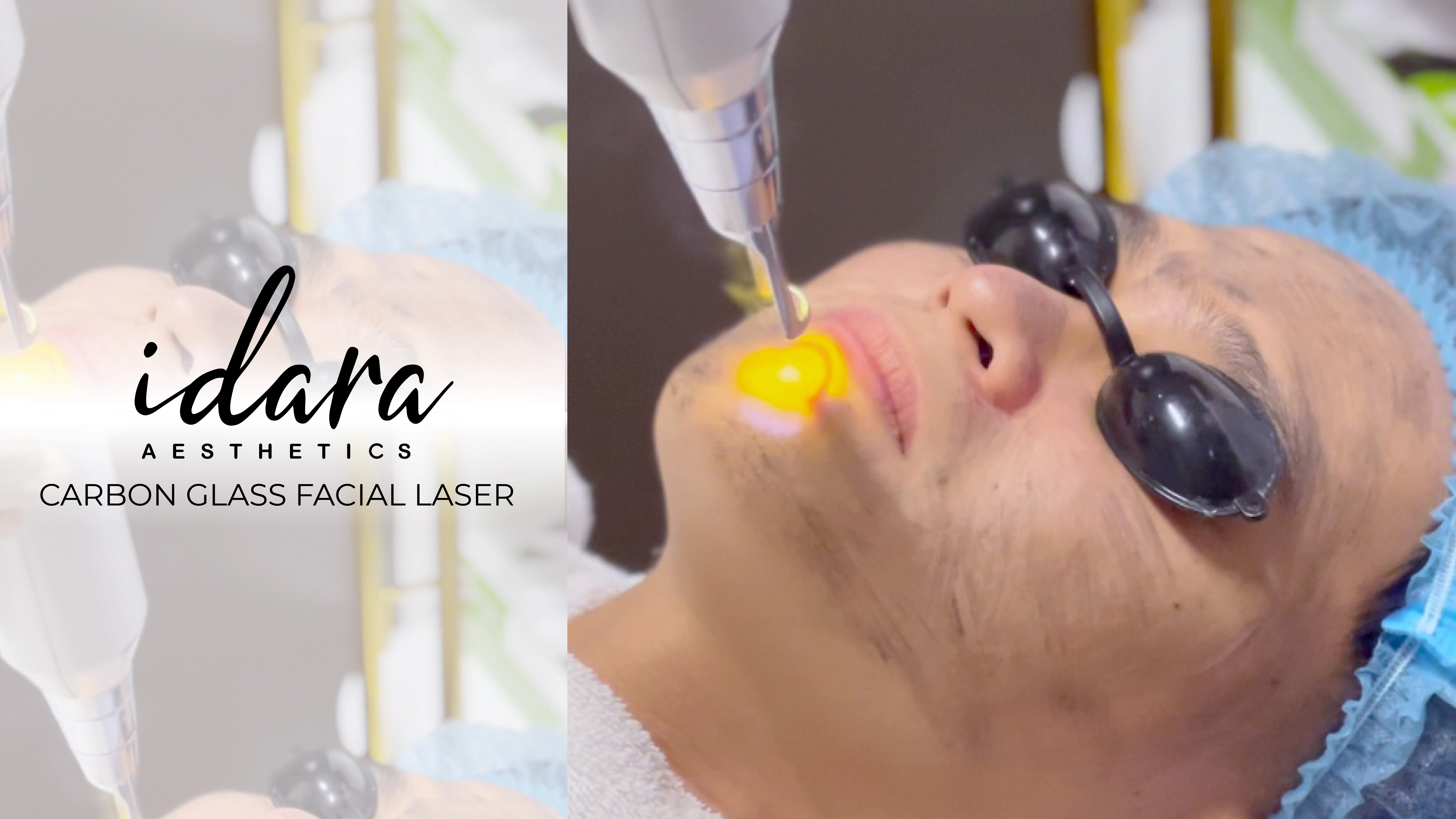 CARBON GLASS FACIAL LASER