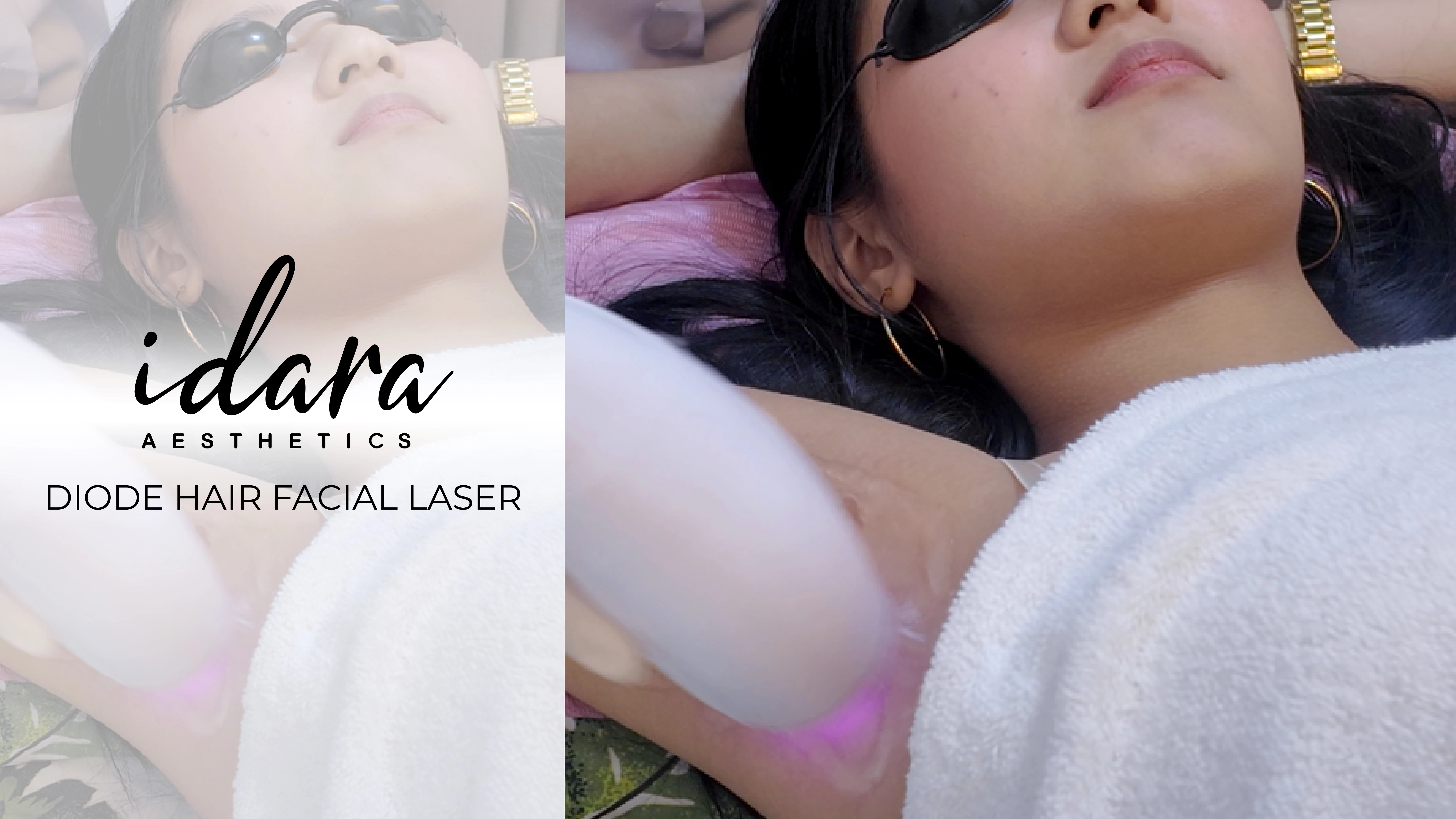 Diode Hair Removal Laser